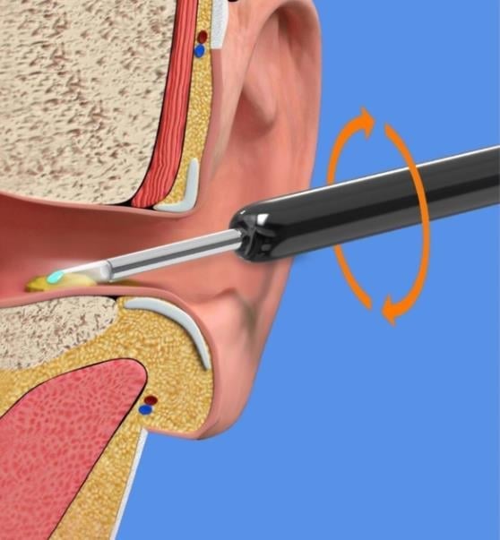 š„Last day! š„Special sale - USB HD Loadable Visual Earwax Cleaner - naotstore