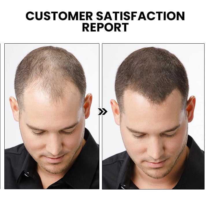 š„Last day! š„Special sale - Ginger Hair Growth Spray - naotstore