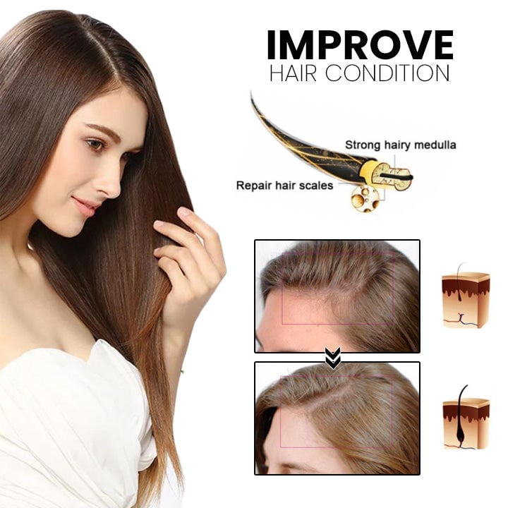 š„Last day! š„Special sale - Ginger Hair Growth Spray - naotstore