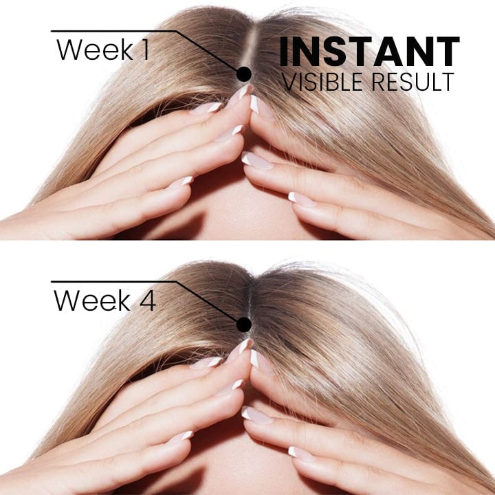 š„Last day! š„Special sale - Ginger Hair Growth Spray - naotstore