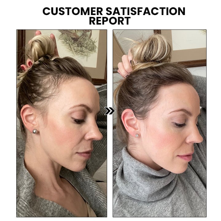 š„Last day! š„Special sale - Ginger Hair Growth Spray - naotstore