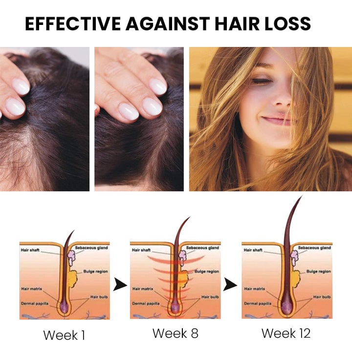 š„Last day! š„Special sale - Ginger Hair Growth Spray - naotstore