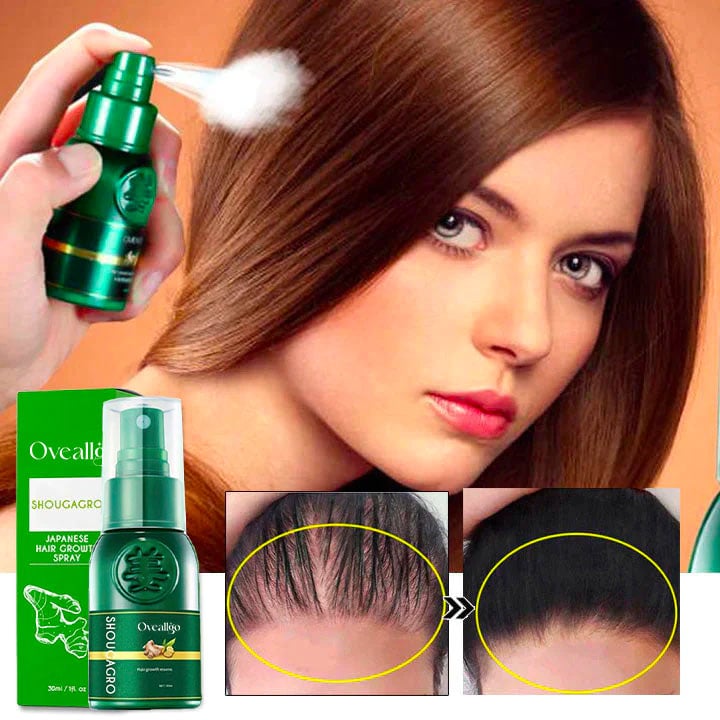 š„Last day! š„Special sale - Ginger Hair Growth Spray - naotstore