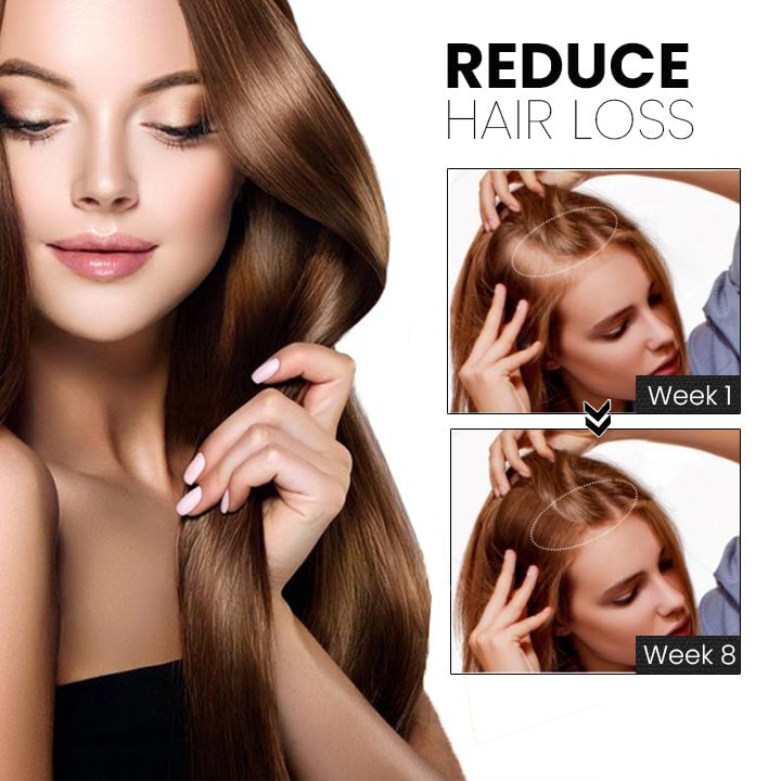 š„Last day! š„Special sale - Ginger Hair Growth Spray - naotstore