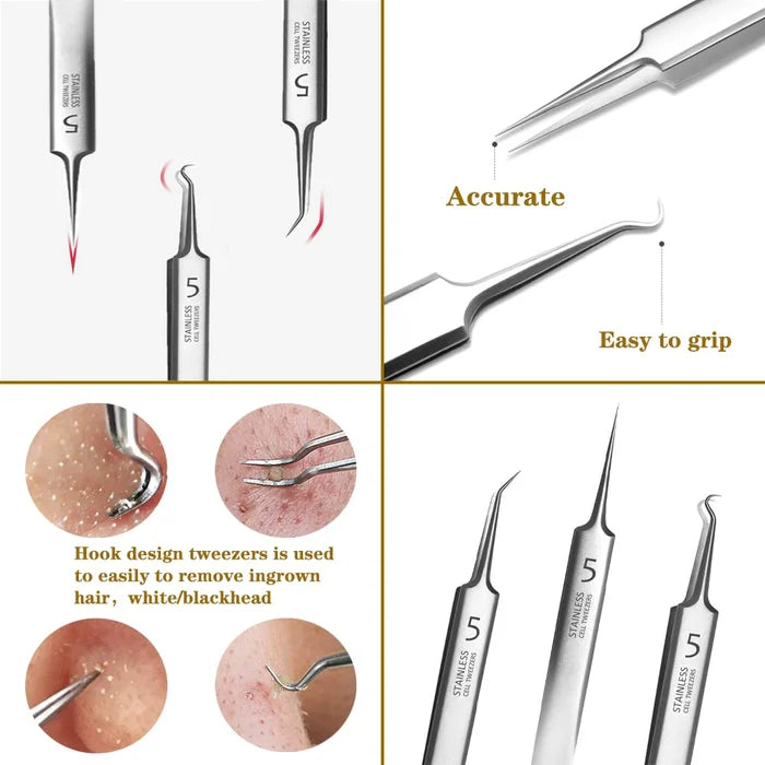 💥🔥Hottest products this month - Professional Facial Blackhead Remover Tweezers - naotstore